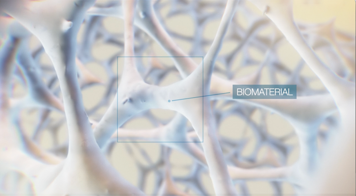 Scaffold biomaterial structure
